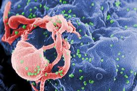 Iowa Scientist Falsifies AIDS research